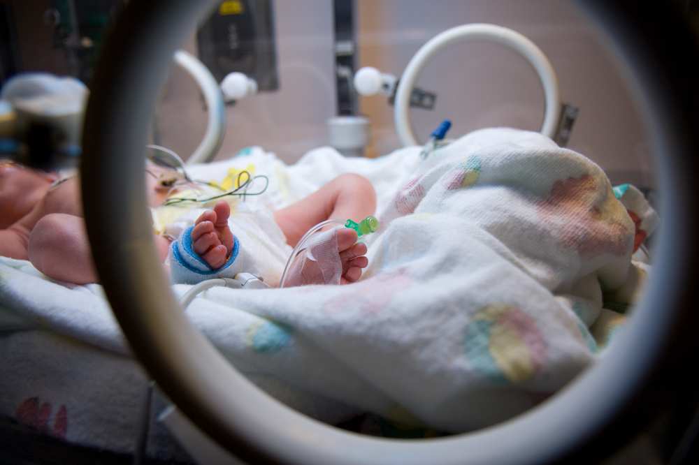 Do Premature Babies Develop Late?