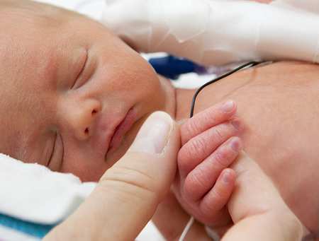 Special and High Dependency Care of the Newborn - getty images.png